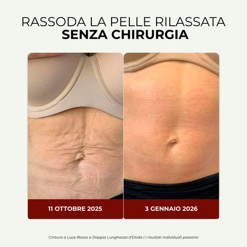 BLOOMI™ | Fascia a Luce Rossa per Rassodare la Pancia e Ritrovare la Fiducia