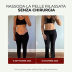 BLOOMI™ | Fascia a Luce Rossa per Rassodare la Pancia e Ritrovare la Fiducia