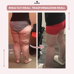 Leggings Bloomi 3D: dì addio al dolore e al gonfiore del lipedema in modo naturale